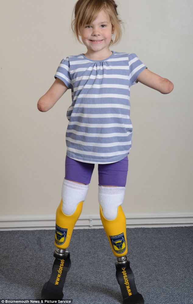 Charlotte Nott, 5, perdeu seus braços e pernas por causa de uma meningite quando ela tinha dois anos.