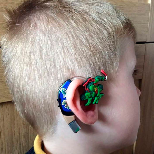 Aparelho auditivo decorado para crianças.