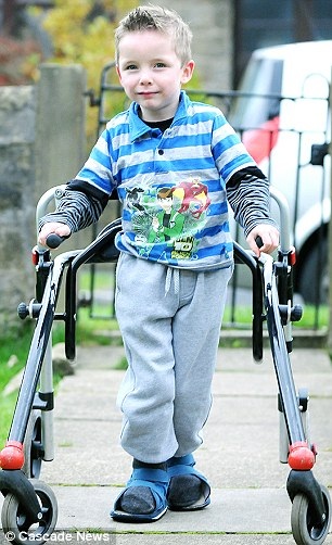Antes da cirurgia: Robin, com 5 anos de idade, só poderia andar com a ajuda de um andador.