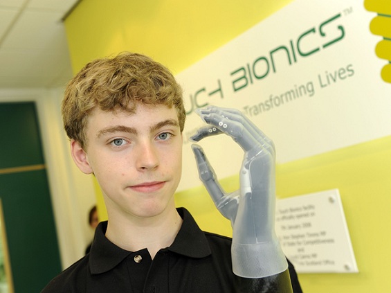 Matthew James exibe a mão biônica que ganhou de presente (Foto: Touch Bionics)