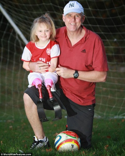 Sentada no joelho do corajoso pai, Ellie Challis desafiou as probabilidades em jogar  futebol com sua equipe na escola (Foto Reprodução: Daily Mail).