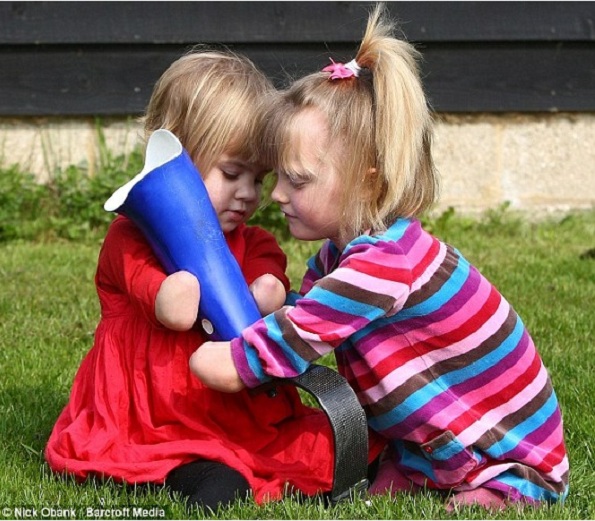 Ellie e sua amiguinha Charlotte que também perdeu os membros porque contraiu meningite (Foto Reprodução: Daily Mail)