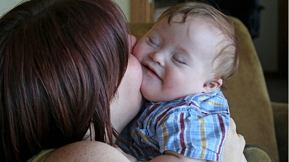 Uma mãe beijando seu bebê com síndrome de down