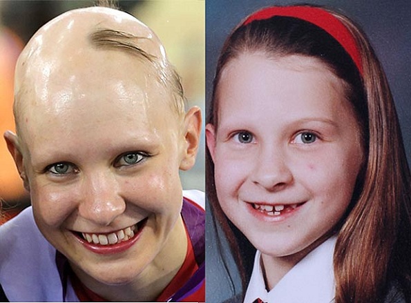 Ciclista Joanna Rowsell com longas madeixas quando criança,  e depois quando conquistou o ouro (Foto: The Sun / Dan Jones)