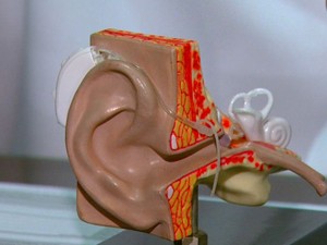 Implante é a única alternativa para que o paciente possa ouvir (Foto: Wilson Aiello/EPTV)