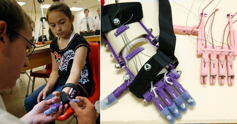 A estudante Kylie Wicker, 9, testa sua mão protética criada em impressora 3D. Foto: Jim Young/Reuters.