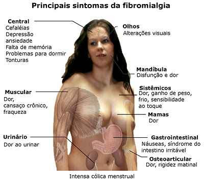 Fibromialgia