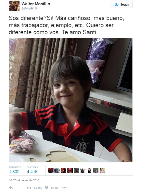 Santino, síndrome de down