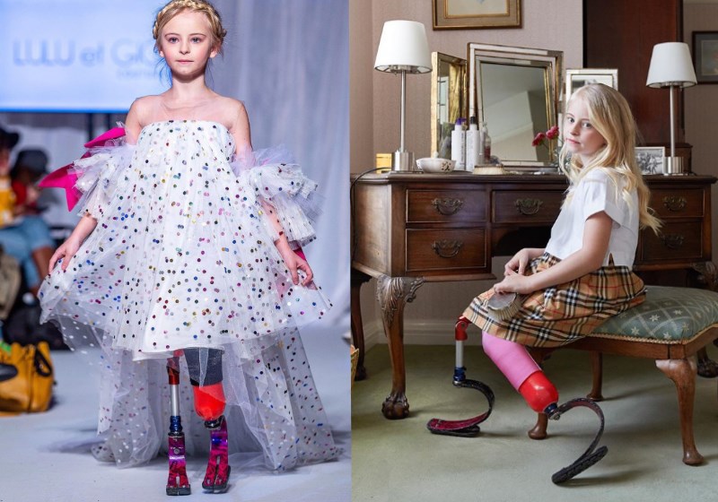 Menina de 9 anos com síndrome de Down é a nova modelo de grife britânica