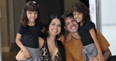 gêmeas siamesas