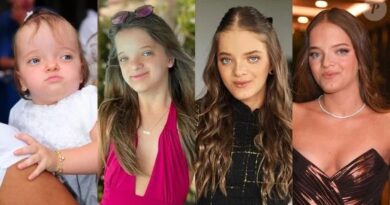 Antes e depois Rafa Justus