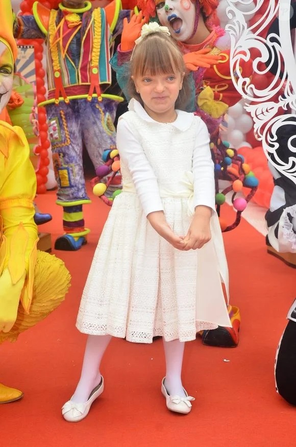 Antes e depois Rafa Justus