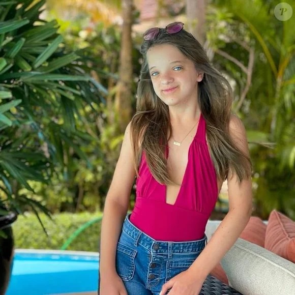 Antes e depois Rafa Justus