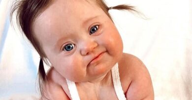 o que aprender com síndrome de down