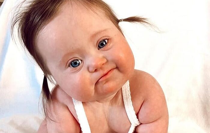 o que aprender com síndrome de down